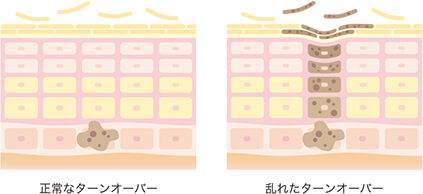 ターンオーバーの仕組み